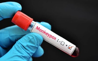 M&D Clinical Corner: Guide to Monkeypox