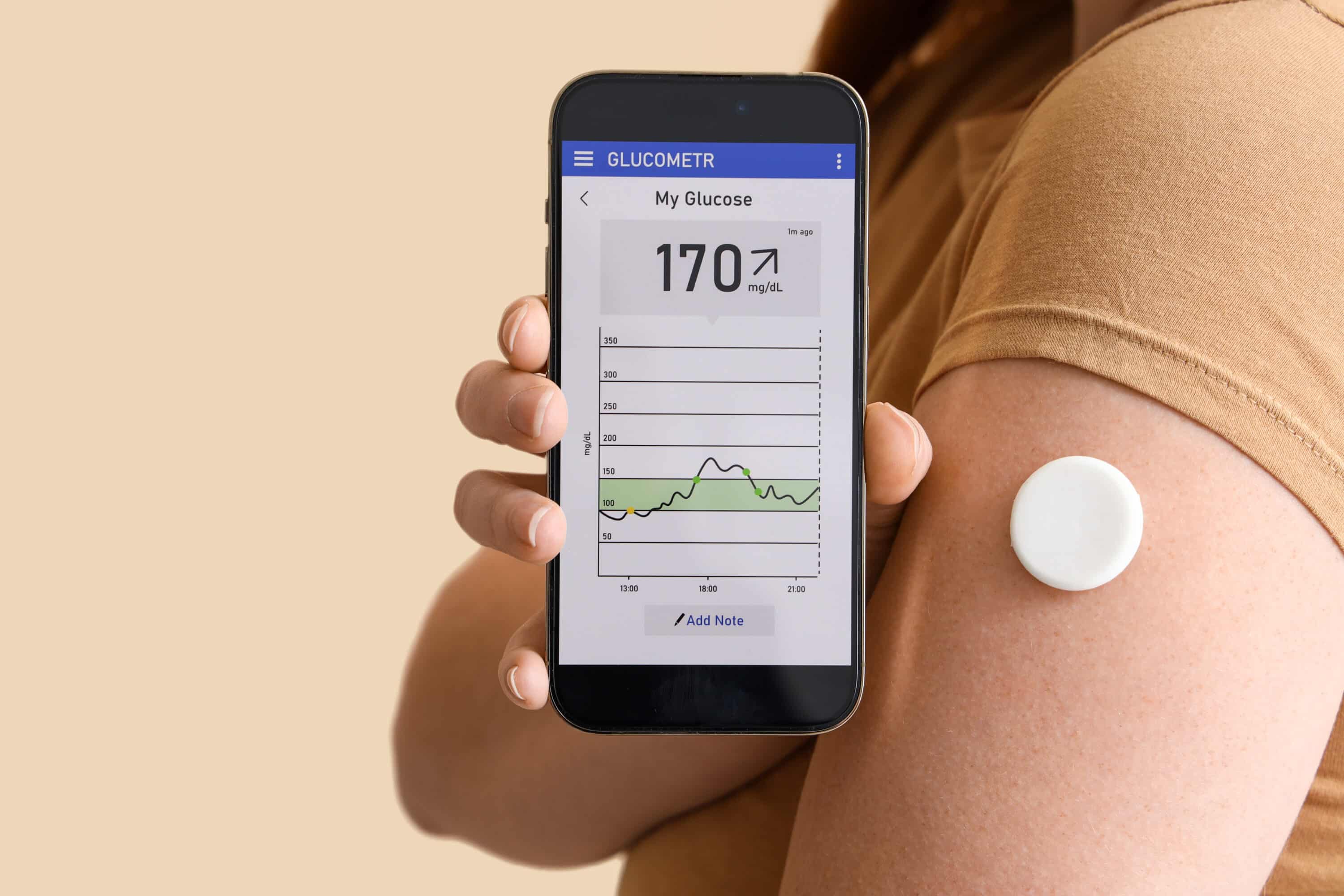 Costco Continuous Glucose Monitor - tyo6mq8