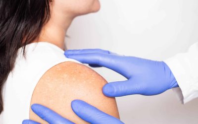 M&D Clinical Corner: UV Safety